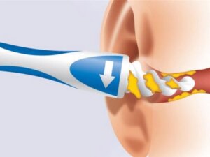 Smart Swab – כלי לניקוי אוזניים + 16 תוספות של ראשי סיליקון!
