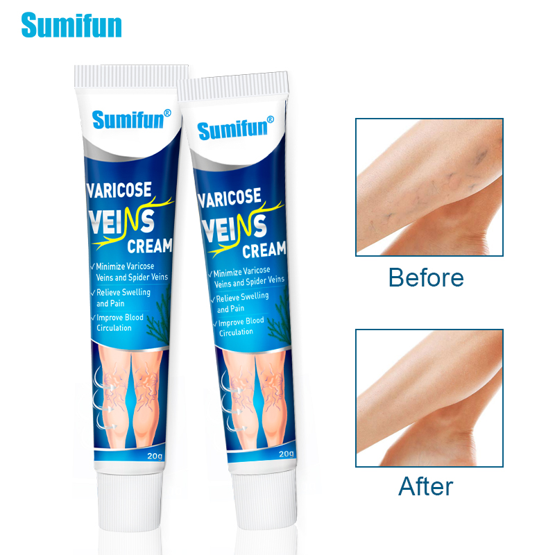 משחה טבעית להעלמת ורידים Varicose מבית Sumifun