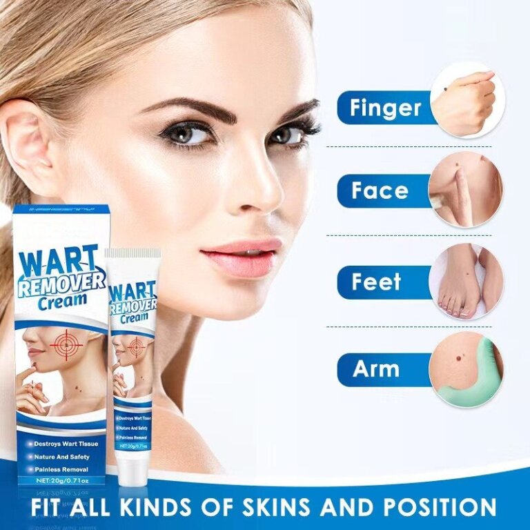 משחה להסרת שומות וסרחי עור WART