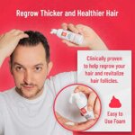 Regenivade – מינוקסידיל 5% קצף + ביוטין אספקה לשישה חודשים – התכשיר המתקדם ביותר!