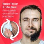Regenivade – מינוקסידיל 5% קצף + ביוטין אספקה לשישה חודשים – התכשיר המתקדם ביותר!