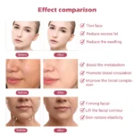 מכשיר EMS להרזיה הרמה ועיצוב הפנים Face Slimmer Xpro