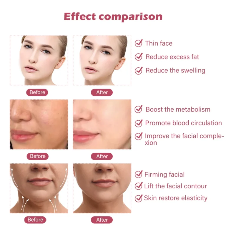 מכשיר EMS להרזיה הרמה ועיצוב הפנים Face Slimmer Xpro