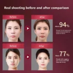 מכשיר EMS להרזיה הרמה ועיצוב הפנים Face Slimmer Xpro