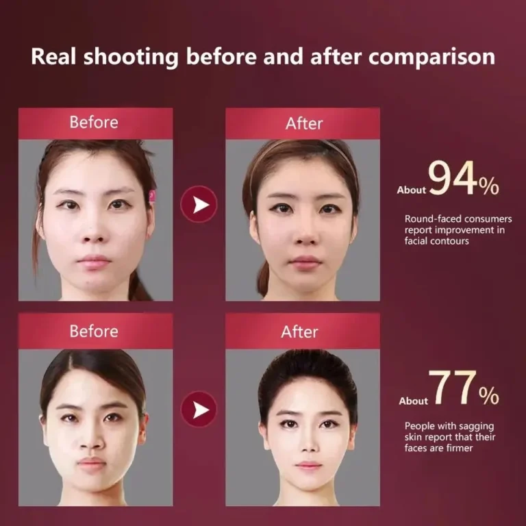 מכשיר EMS להרזיה הרמה ועיצוב הפנים Face Slimmer Xpro
