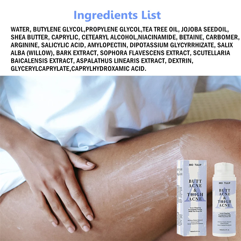 קרם לטיפול באקנה בגוף